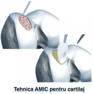 capacitatea de regenerare a tipurilor de cartilaj